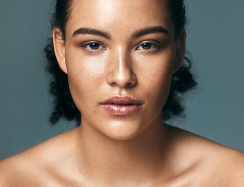 ¡Despídete del Melasma! Descubre los Avances más Recientes en su Tratamiento
